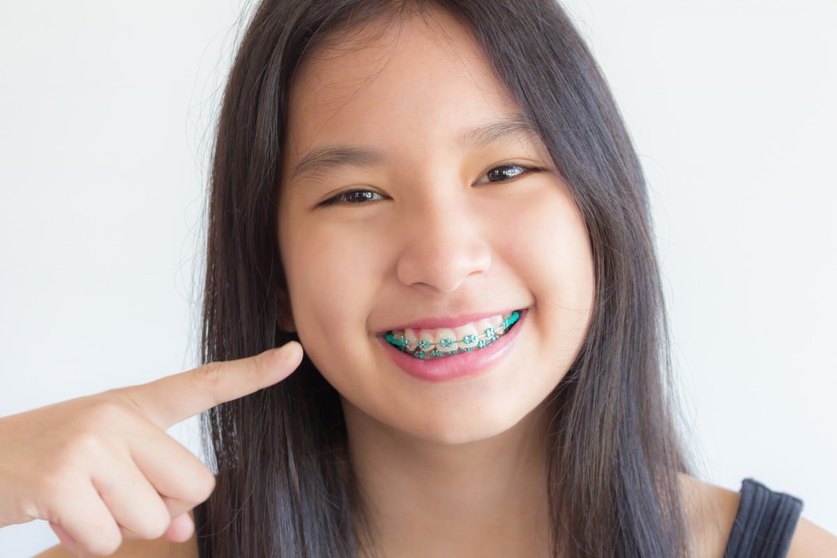Featured image for “How to Brush Your Teeth with Braces”