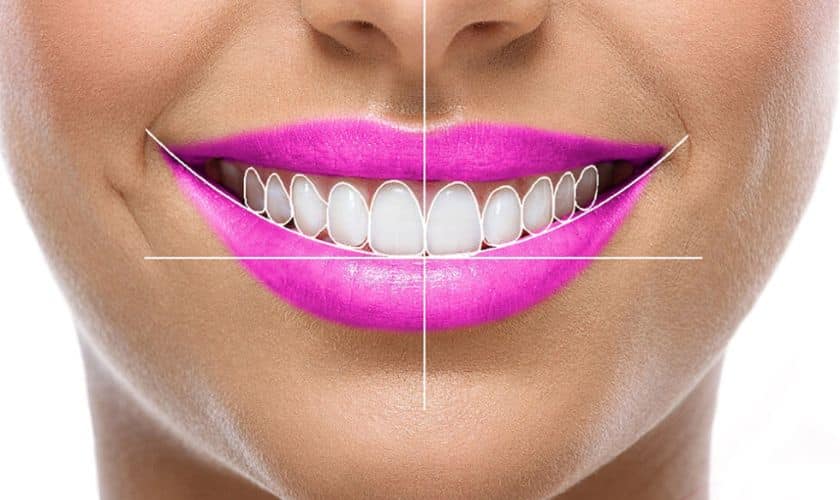 Featured image for “Cosmetic Smile Design & Makeover – Can Turn Your Ordinary Smile Into A Stunning One?”