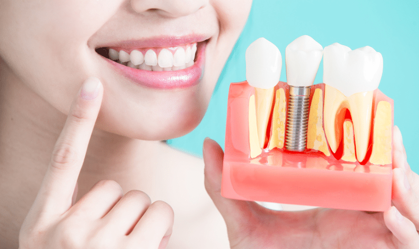 Featured image for “Exploring the Different Types of Dental Implants in Corpus Christi”