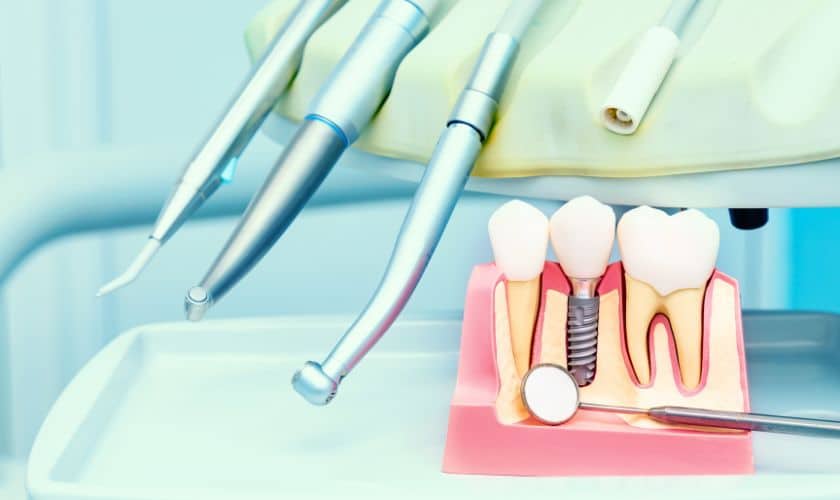 Featured image for “How Dental Implants Can Transform Your Confidence”