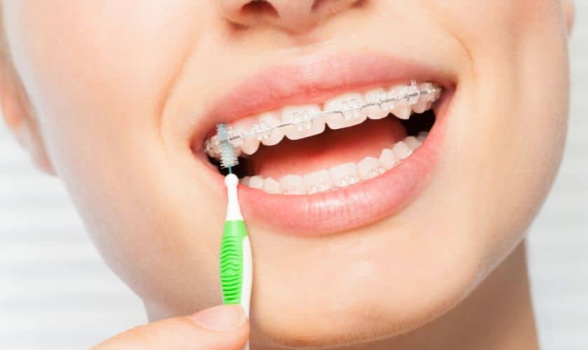 Featured image for “Adult Orthodontics: Achieving Straighter Teeth at Any Age in Corpus Christi”