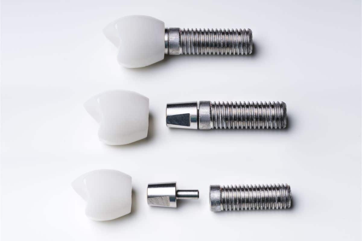 Dental Implants