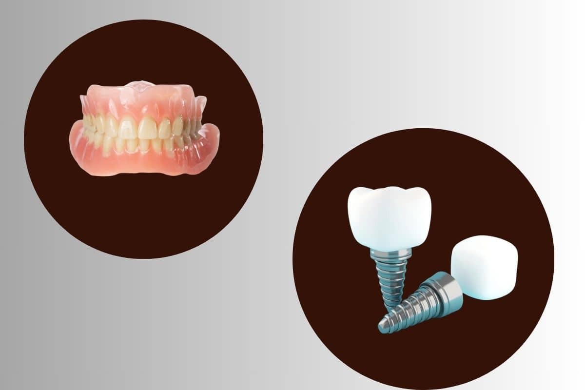 Dental Implants Over Dentures