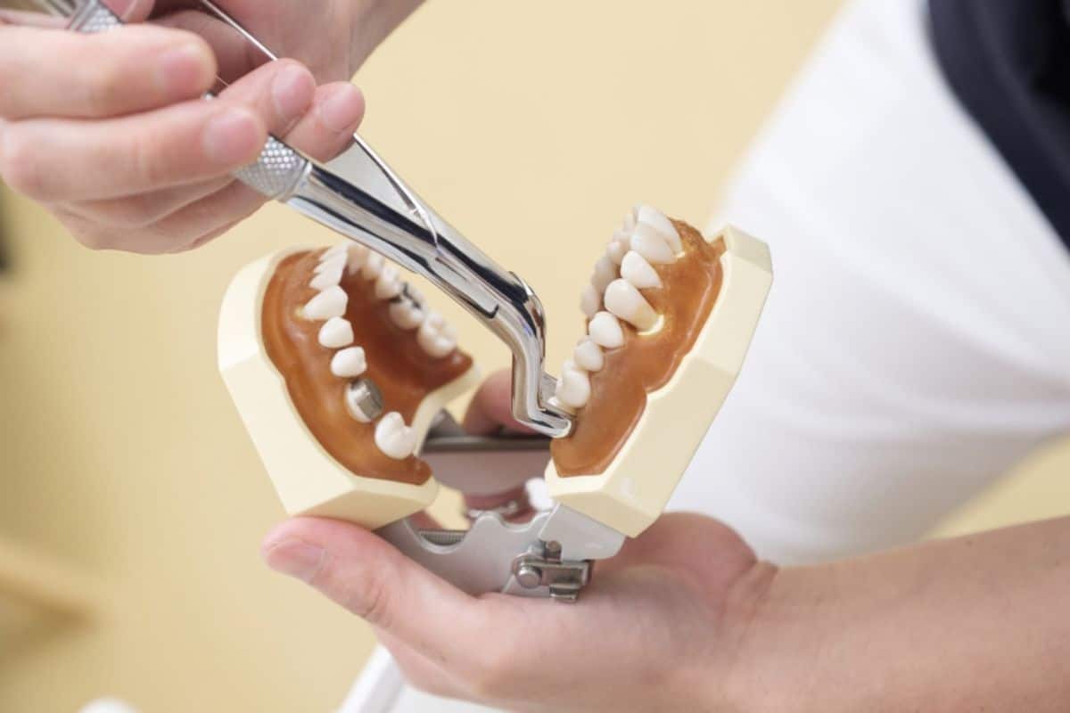 tooth extraction corpus christi